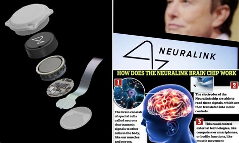 elon musk rfid chip|Elon Musk's Neuralink Has Implanted Its First Chip in a Human .